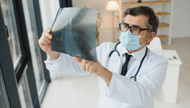Médico usando máscara e óculos analisa uma radiografia de tórax segurando o exame contra a luz de uma janela.