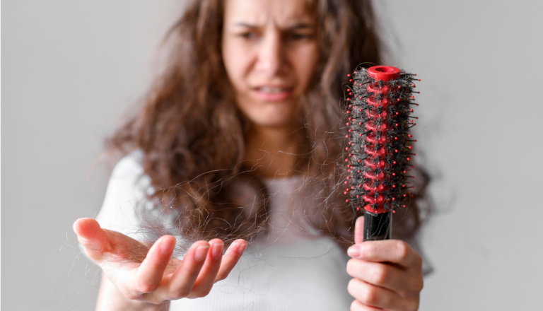 Mulher com expressão de preocupação observa fios de cabelo caídos na mão e presos em uma escova de cabelo, ilustrando queda capilar.